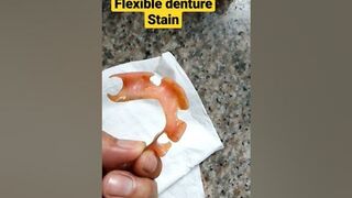 Flexible Denture Stain.