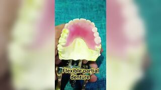 flexible partial denture by Ali dental ceramic and ideas #partialdenture #completedenture