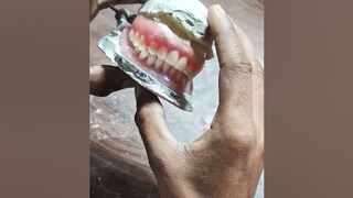 Flexible #Flexible teeth #Flexible teeth denture #Flexible denture front teeth