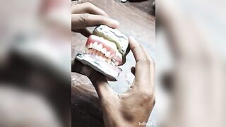 Flexible #Flexible teeth #Flexible teeth denture #Flexible denture front teeth