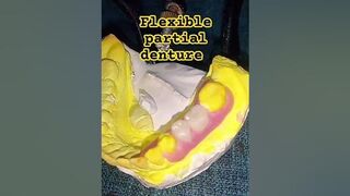 flexible partial denture by Ali dental ceramic #partialdenture #completedenture #removabledenture