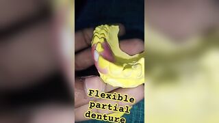 flexible partial denture by Ali dental ceramic #removabledenture #partialdenture #completedenture