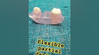 flexible partial denture by Ali dental ceramic #completedenture #removabledenture #partialdenture