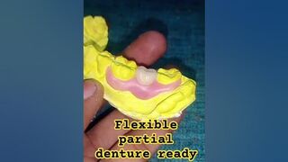 flexible partial denture ready for flask by Ali dental ceramic #removabledenture #partialdenture