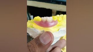 2 Unit Flexible Partial Denture By Haider #dentalartbyhaider #dentures #rpd