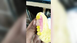 2 Unit Flexible Partial Denture By Haider #dentalartbyhaider #dentures #rpd