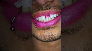 Flexible natural false teeth #viral #dentist #satisfying #mrdent