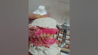 waxing of complete dentures flexible