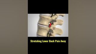 Stretching Lower Back Pain Away #backpain #sciatica #chiropractic #lowerbackpain #fypage #fy #foryou