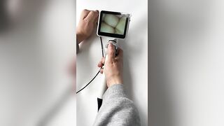 Flexible Video Laryngoscope for Hospital Clinical Intubation