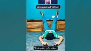 varicose veins treatment #varicoseveinstreatment#yoga #yogafittness#homeworkout#excercise #fitness