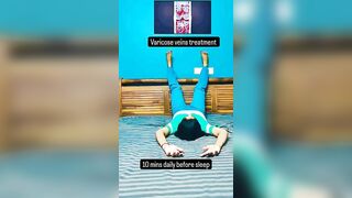 varicose veins treatment #varicoseveinstreatment#yoga #yogafittness#homeworkout#excercise #fitness