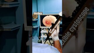 Urethra and bladder examin with flexible cysto scopy(camera)hBy Dr Faisal (urologist) city hospital