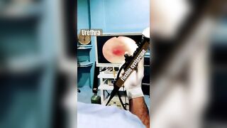 Urethra and bladder examin with flexible cysto scopy(camera)hBy Dr Faisal (urologist) city hospital