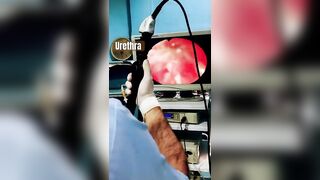 Urethra and bladder examin with flexible cysto scopy(camera)hBy Dr Faisal (urologist) city hospital