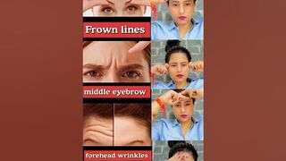 ????♨️Anti-aging yoga,frown lines, 11lines,middle eyebrow wrinkles reduce forehead wrinkle try???? #shorts