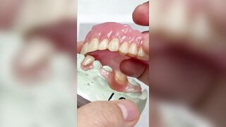 Flexible partial and denture for one patient!