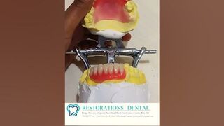 Initial stages of FLEXIBLE DENTURES #dentistryworld #dental #shortvideo #dentistry