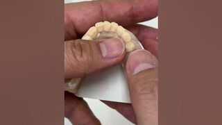 Clear Flexible Partial @EnvisiontecMain #envisiontec #dental #short #shorts #shortvideo #shortsvideo