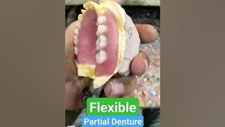 Upper And Lower Flexible Partial Denture By Haider #dentalartbyhaider #rpd #dentures #dentist