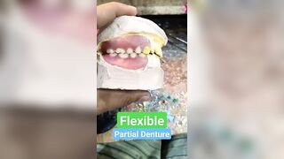 Upper And Lower Flexible Partial Denture By Haider #dentalartbyhaider #rpd #dentures #dentist